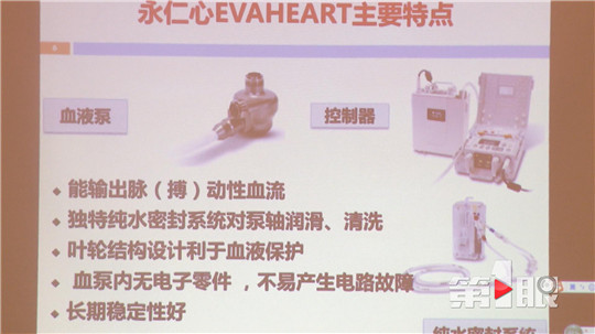 “重庆造”人工辅助心脏来啦！填补国内技术空白
