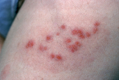 廣州老伯稱自己痛到不想活 家人還以為他裝病