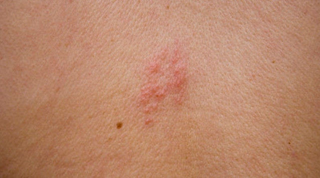 廣州老伯稱自己痛到不想活 家人還以為他裝病