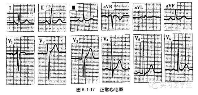 心电图零基础到有序阅读