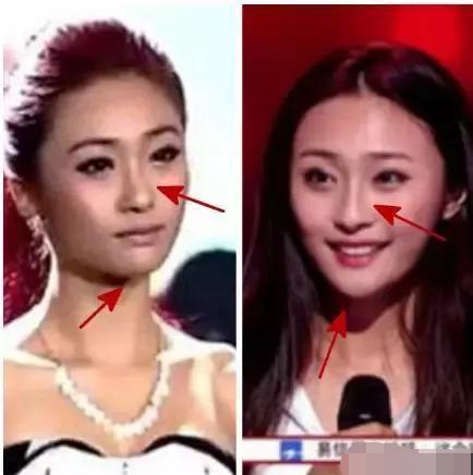 还记得《好声音》里那英力保的富二代吗？她现在整得完全认不出了 - 15