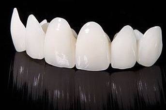 为什么牙医会推荐二氧化锆全瓷牙?