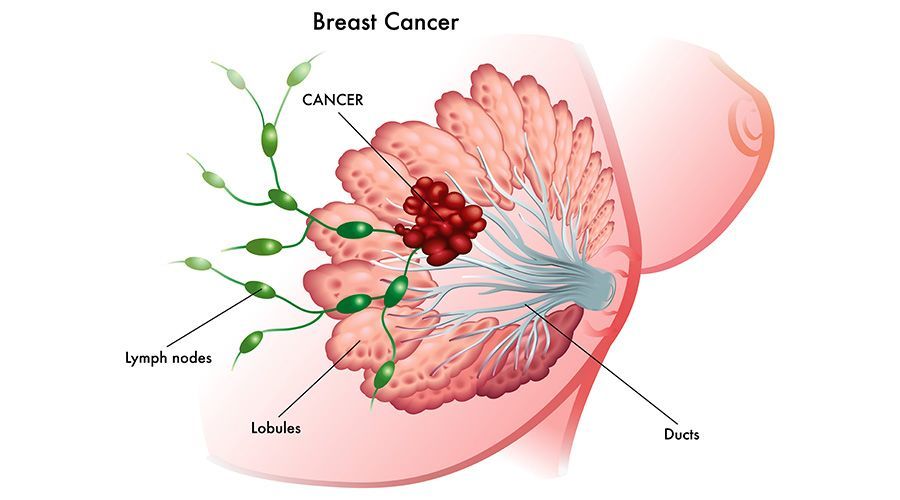 乳腺增生一定要治吗什么时候必须看医生