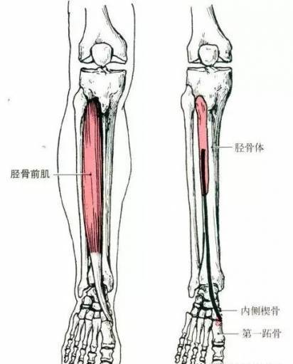 跑步小腿前侧酸痛?可能是你的胫骨前肌在作祟!