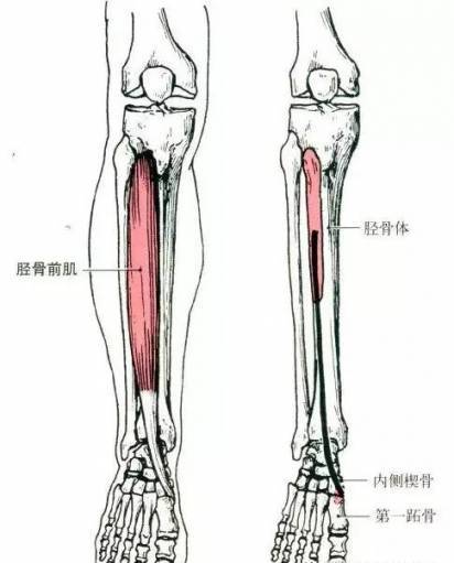 可能是你的胫骨前肌在作祟!
