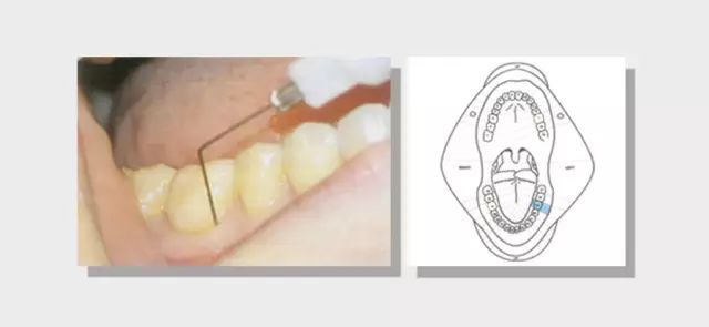 口腔局部麻醉技术