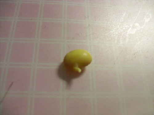 1岁女婴咀嚼时受到惊吓 一粒黄豆要了她的命