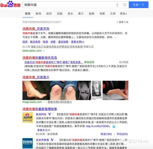 回应滑膜肉瘤患者死亡事件后 百度仍存在这样