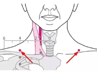 缺盆穴气喘咽喉肿痛缺盆中痛