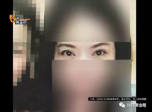 女子在美容医院花五万元整形后反而更丑，觉得自己被骗，竟给医院寄断臂 - 2