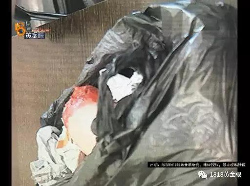 女子在美容医院花五万元整形后反而更丑，觉得自己被骗，竟给医院寄断臂 - 6
