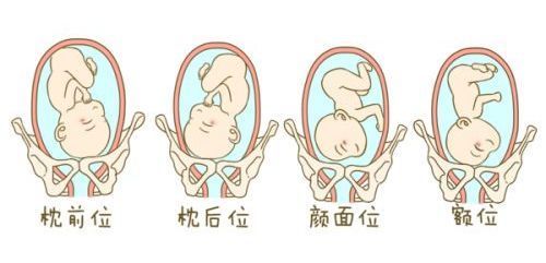 39周胎儿双顶径90,我能不能顺产?做哪些运动