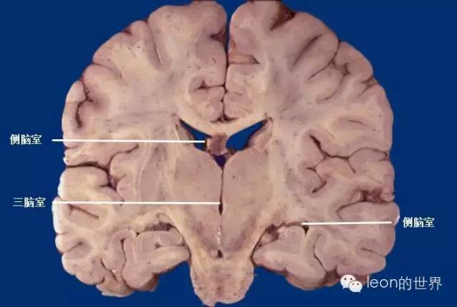 解剖 ▏史上最全脑室解剖图谱