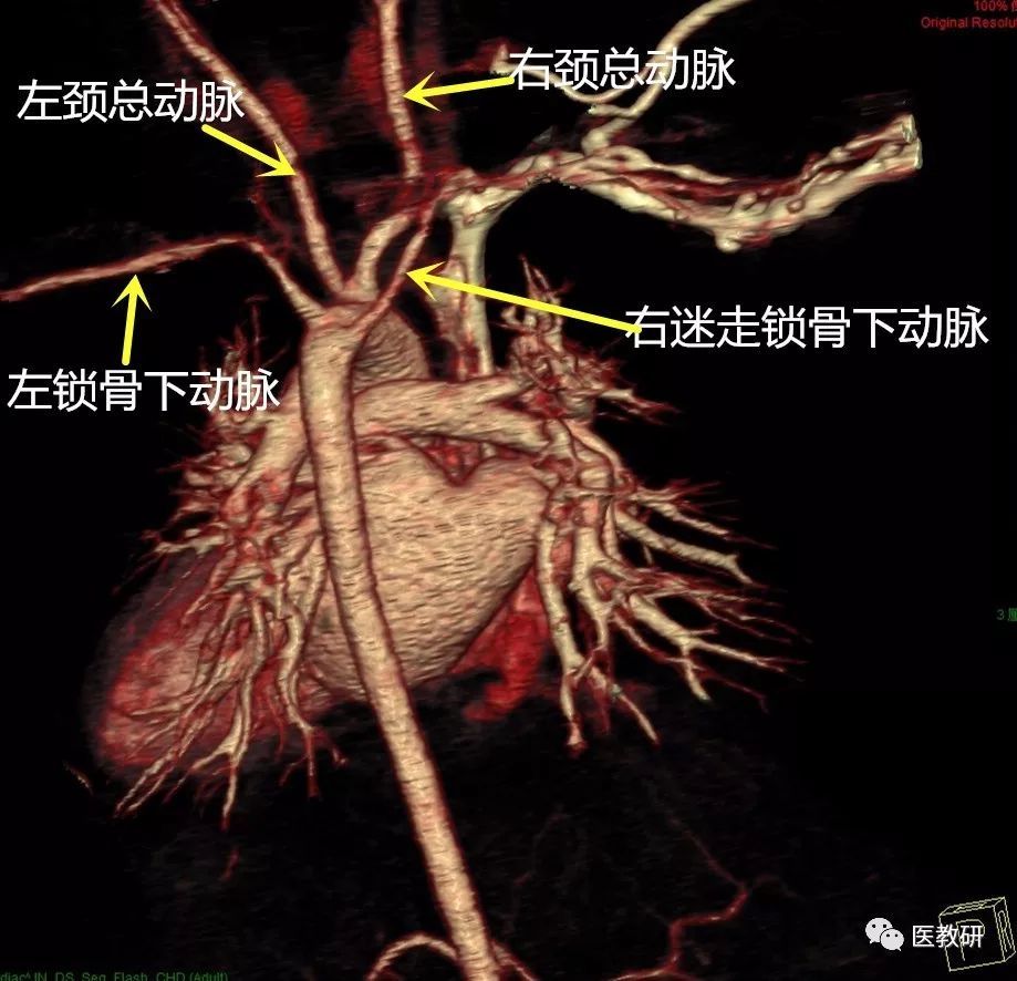 永存动脉干