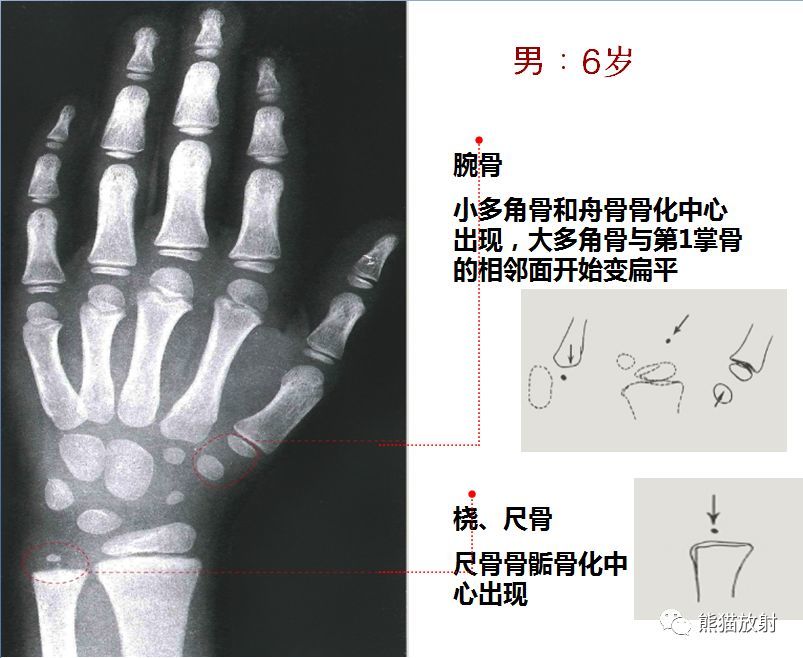 儿童生长发育骨龄图谱