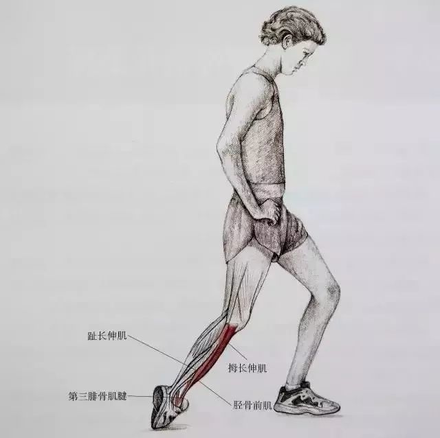 运动前后进行伸展练习对肌肉疼痛和创伤危险的作用_热隆伸展构造_伸展作用