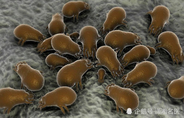 郴州一女子身上长水疱浑身痒 元凶是螨虫