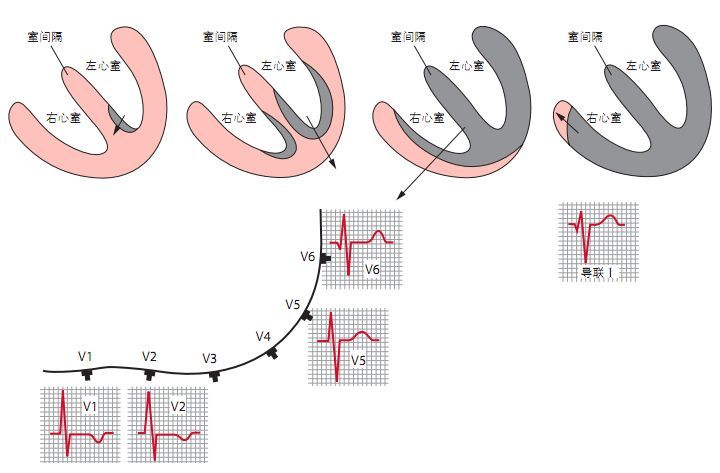 12s)且有切迹(第二部分高大).v1导联 左心室的重量远大于右心室.