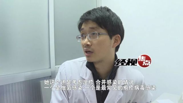 长沙9岁女孩患怪病脸起红疹 鼻子、嘴巴肿胀