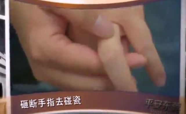 为了“碰瓷”，东莞一打工男子真把手指砸成骨折