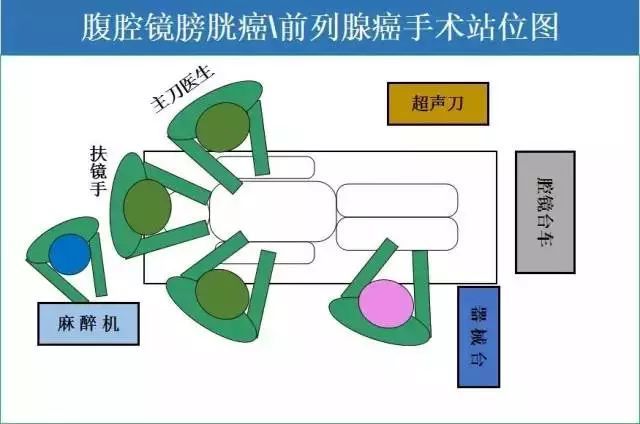 最全手术"排兵布阵"站位图解,拿走不谢!