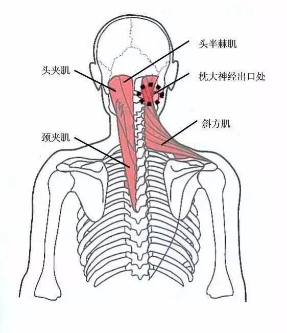 肩部压痛点检查