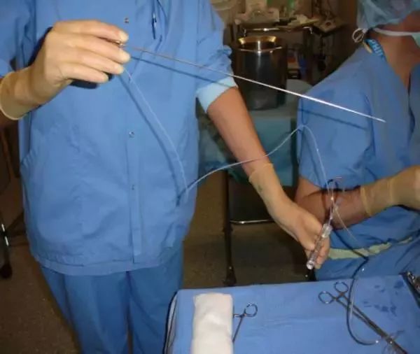 娄底一女子花16万做试管婴儿包生男孩? 取卵全