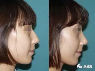 男孩下巴缩是什么命