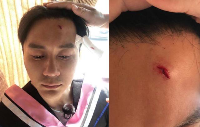 继李晨后陈赫也被曝出膝盖受伤,网友:用生命在