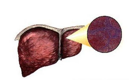 47岁男子酒精中毒昏迷,抢救三天才保住命,最终