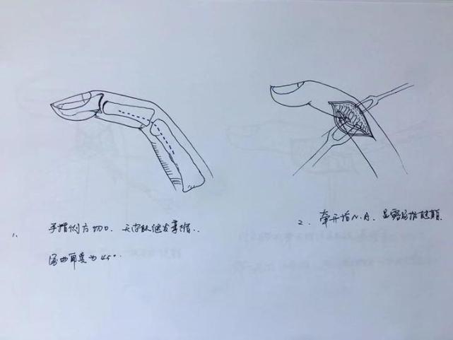 教案模板表格_体育课表格教案模板_教案表格模板范文医学