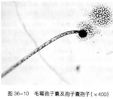 肺孢子菌:孢子,无菌丝.新型隐球菌:无孢子,无菌丝.