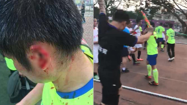 足协整治业余球赛暴力 建立全国黑名单系统