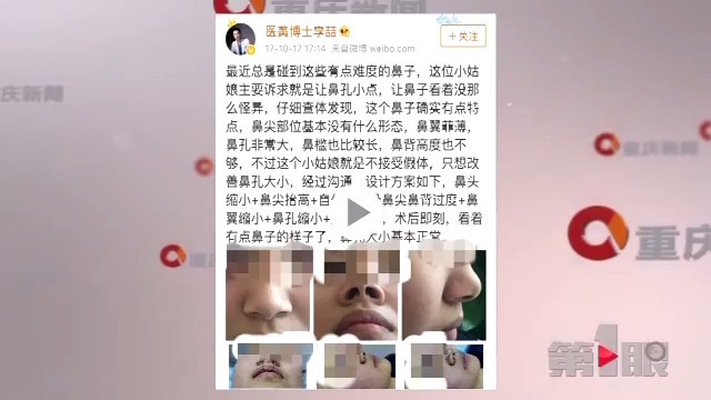 意外不意外?女子刷微博竟刷出自己的整容照片