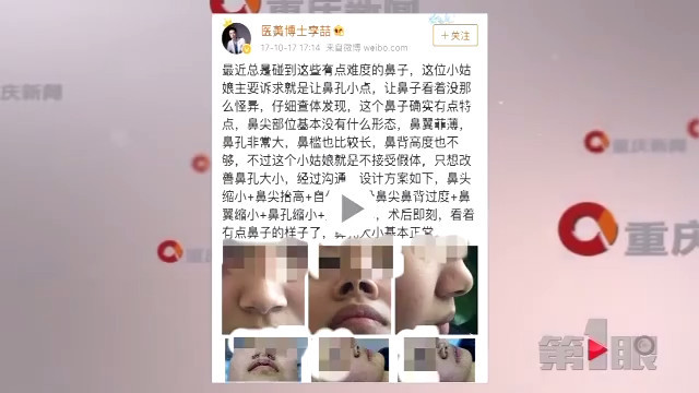 意外不意外？女子刷微博竟刷出自己的整容照片