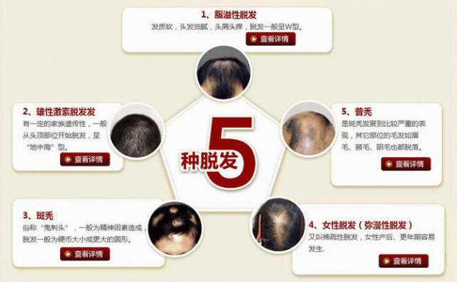 QQ图片20160615121243