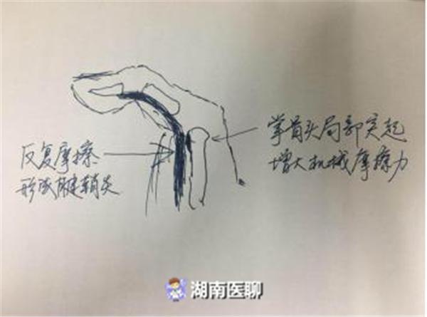 长沙14岁女孩每天刷手机到半夜 大拇指疼不停