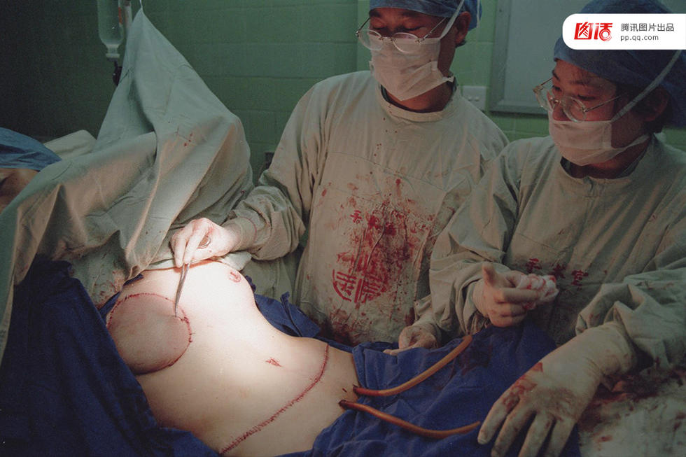 乳房再造手术通过假体植入或皮瓣移植的方法,再造一个与正常乳房相似