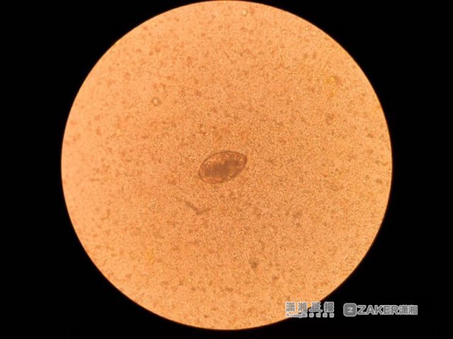 湖南一两岁孩子爱喝生水 反复发热四个月患肺