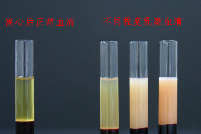 顿顿小龙虾义乌男子被抽出整整一管牛奶血