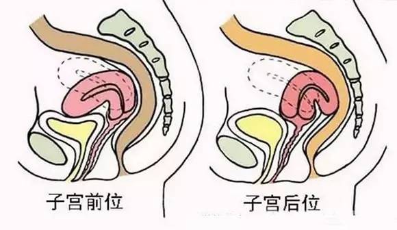 子宫前位是指子宫颈是向下指向阴道后穹窿,它在体内的位置较低,所以