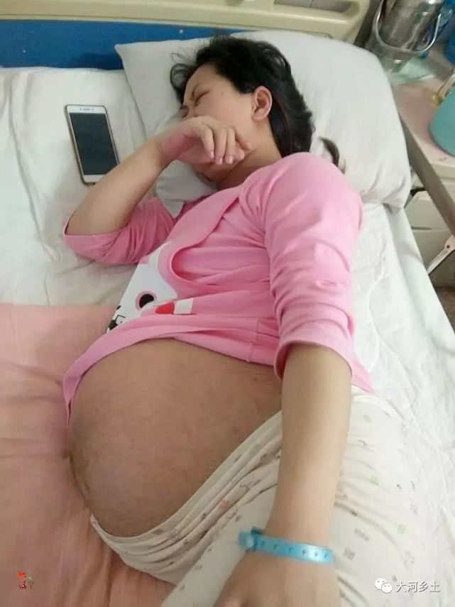 女子产同卵三胞胎,出现概率为两亿分之一,分娩