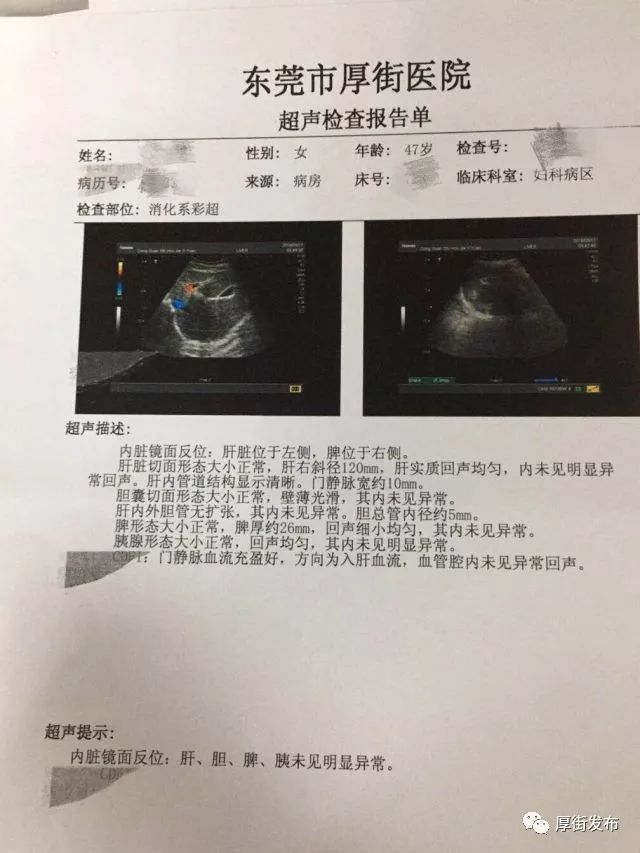 東莞一病人“五臟六腑”全長反 醫(yī)生：做手術(shù)如腦筋急轉(zhuǎn)彎