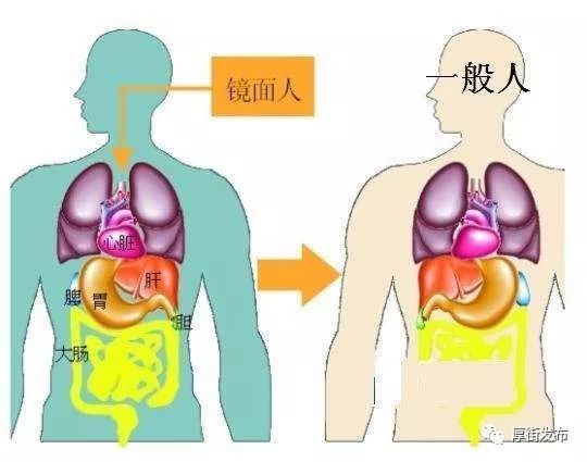東莞一病人“五臟六腑”全長反 醫(yī)生：做手術(shù)如腦筋急轉(zhuǎn)彎