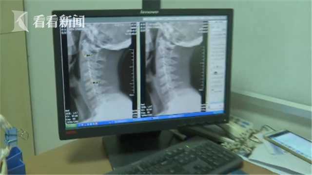 家长注意!九岁男童长时间低头玩手机 致颈椎变