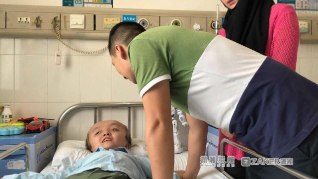 9岁大头娃娃成功缩颅 颅骨缩短7厘米头部减