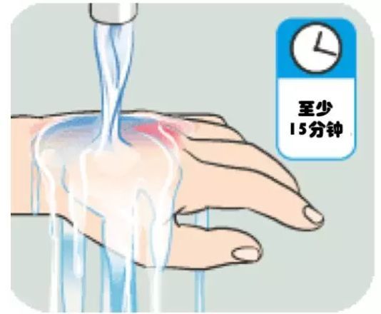 孩子烧烫伤后别轻信土办法,这个冲脱泡盖送的