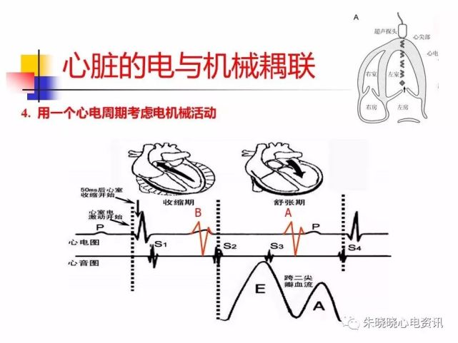 电-机械耦联与房室同步(ppt)