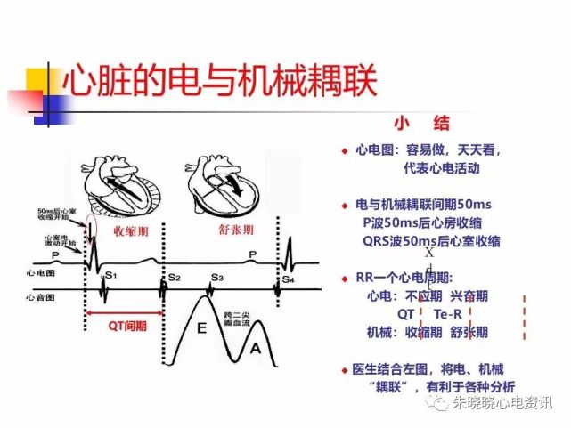 电-机械耦联与房室同步(ppt)