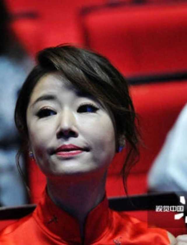 为什么视觉中国镜头下的林心如这么丑?
